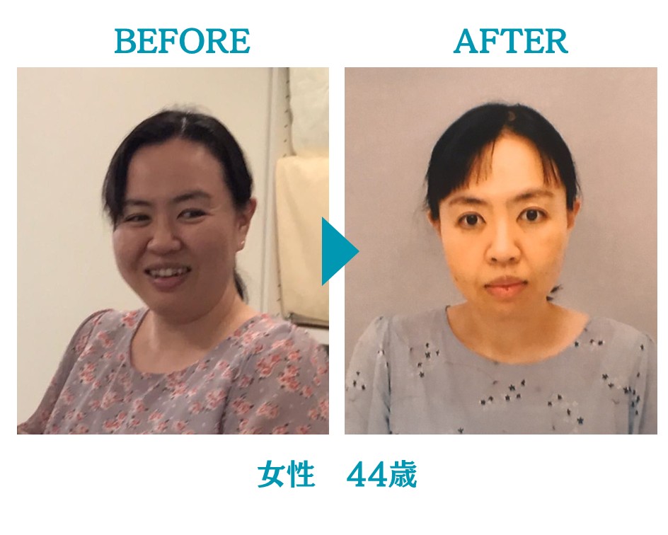 新粥様ビフォーアフター